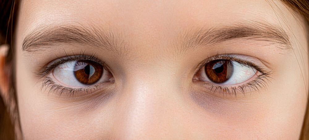 Binocular Vision Dysfunction Symptoms, Causes, and How to Fix It